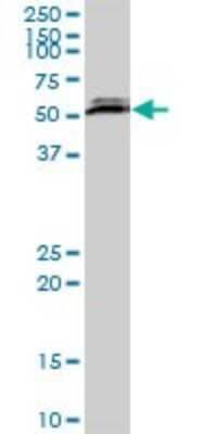 Western Blot: CSTF2T Antibody [H00023283-B01P]