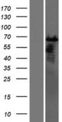 Western Blot: CSTF2T Overexpression Lysate [NBP2-07200]