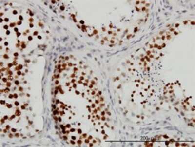 Immunohistochemistry-Paraffin: CSTF3 Antibody (1D4) [H00001479-M01]