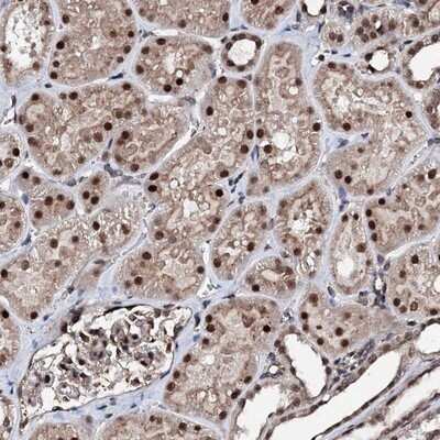 Immunohistochemistry-Paraffin: CSTF3 Antibody [NBP1-85427]
