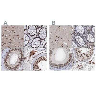 Immunohistochemistry-Paraffin: CSTF3 Antibody [NBP1-85427]