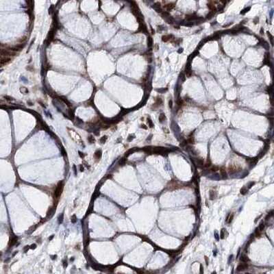 Immunohistochemistry-Paraffin: CSTF3 Antibody [NBP1-85427]