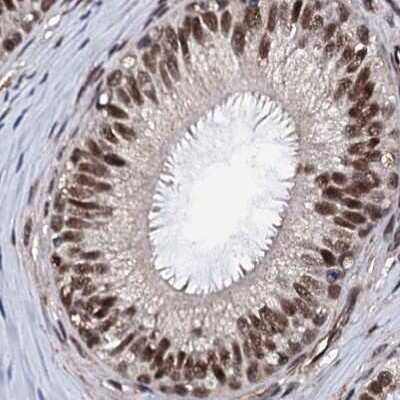Immunohistochemistry-Paraffin: CSTF3 Antibody [NBP1-85427]