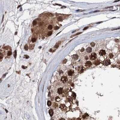 Immunohistochemistry-Paraffin: CSTF3 Antibody [NBP1-85427]