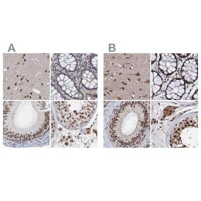 Immunohistochemistry-Paraffin: CSTF3 Antibody [NBP1-85428]