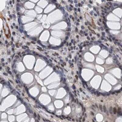 Immunohistochemistry-Paraffin: CSTF3 Antibody [NBP1-85428]
