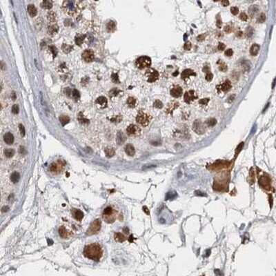 Immunohistochemistry-Paraffin: CSTF3 Antibody [NBP1-85428]