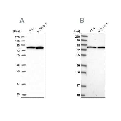 Western Blot: CSTF3 Antibody [NBP1-85427]