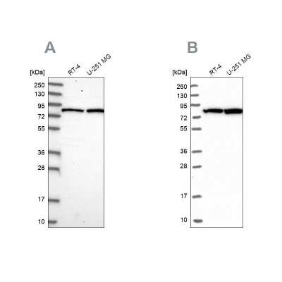 Western Blot: CSTF3 Antibody [NBP1-85428]