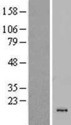 Western Blot: CSTL1 Overexpression Lysate [NBP2-05682]