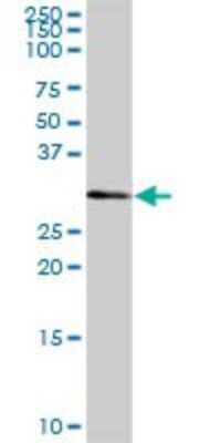 Western Blot: CSTP1 Antibody [H00055313-B01P]