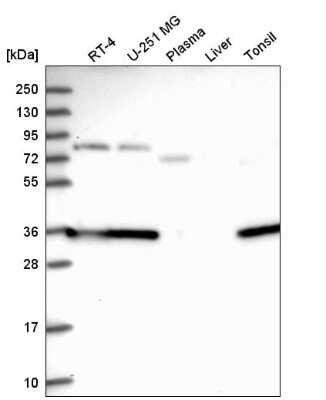 Western Blot: CSTP1 Antibody [NBP2-58995]