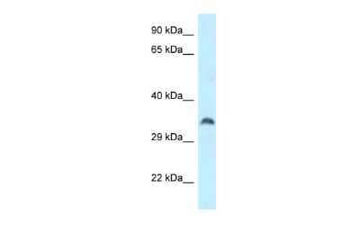 Western Blot: CSTP1 Antibody [NBP2-87222]