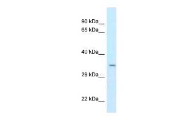 Western Blot: CSTP1 Antibody [NBP2-87223]