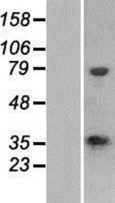 Western Blot: CSTP1 Overexpression Lysate [NBP2-06819]