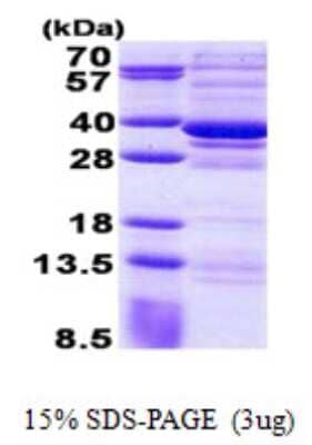 SDS-PAGE: Recombinant Human CSTP1 His Protein [NBP2-22723]