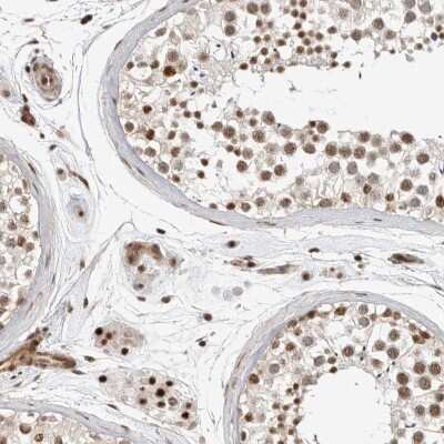 Immunohistochemistry-Paraffin: CT110 Antibody [NBP1-88045]