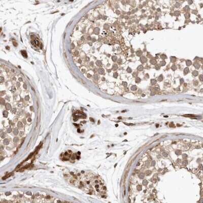 Immunohistochemistry-Paraffin: CT110 Antibody [NBP1-88046]