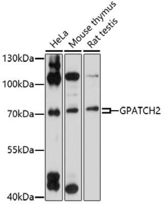 Western Blot: CT110 AntibodyAzide and BSA Free [NBP2-92349]