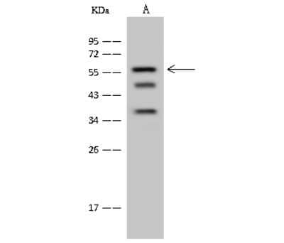 Western Blot: CT110 Antibody [NBP2-99286]