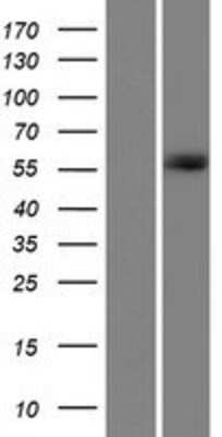 Western Blot: CT110 Overexpression Lysate [NBP2-06880]