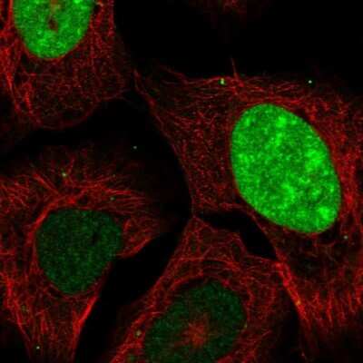 Immunocytochemistry/ Immunofluorescence: CT45A1 Antibody [NBP2-46736]