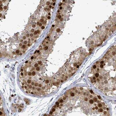 Immunohistochemistry-Paraffin: CT45A1 Antibody [NBP2-46704]