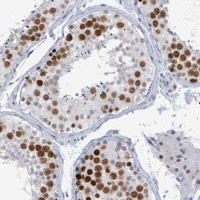 Immunohistochemistry: CT45A1 Antibody [NBP2-46736]