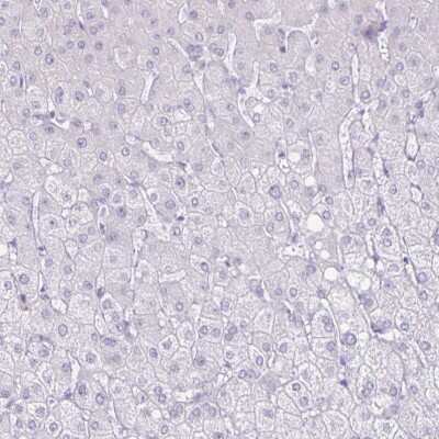 Immunohistochemistry-Paraffin: CT45A1 Antibody [NBP2-46702]