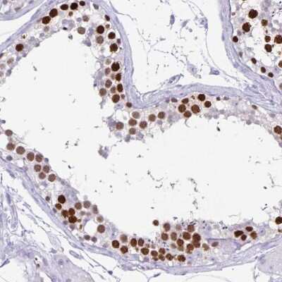 Immunohistochemistry-Paraffin: CT45A1 Antibody [NBP2-46702]