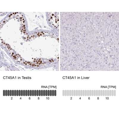Immunohistochemistry-Paraffin: CT45A1 Antibody [NBP2-46702]