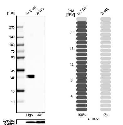 Western Blot: CT45A1 Antibody [NBP2-46702]