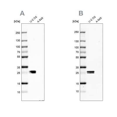 Western Blot: CT45A1 Antibody [NBP2-46702]