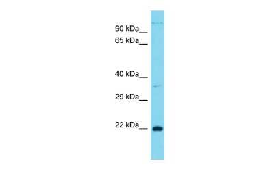 Western Blot: CT45A1 Antibody [NBP3-10719]