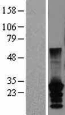 Western Blot: CT45A2 Overexpression Lysate [NBL1-09559]