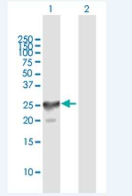 Western Blot: CT45A4 Antibody [H00441520-B01P-50ug]