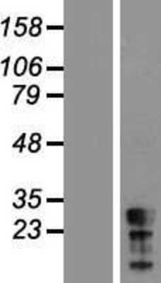 Western Blot: CT45A5 Overexpression Lysate [NBL1-09560]