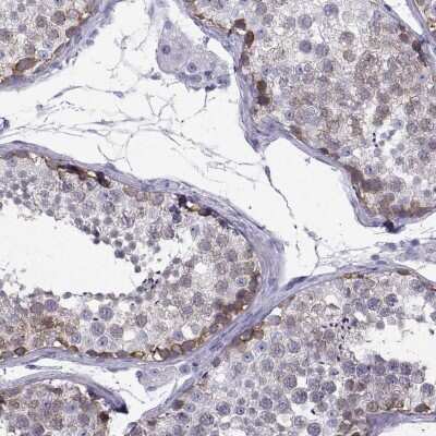 Immunohistochemistry-Paraffin: CT47A11 Antibody [NBP2-54698]