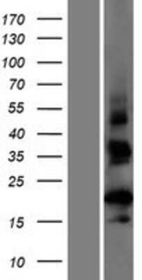 Western Blot: CT62 Overexpression Lysate [NBP2-08245]