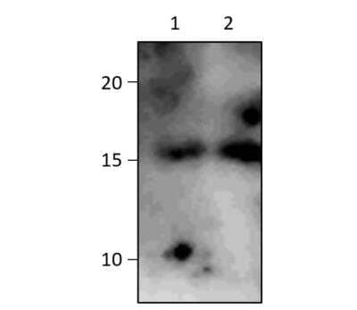 Western Blot: CT83 Antibody [NBP3-12388]