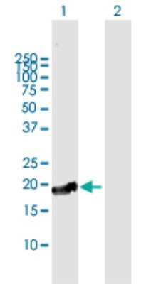 Western Blot: CTAG1A Antibody [H00246100-B01P]