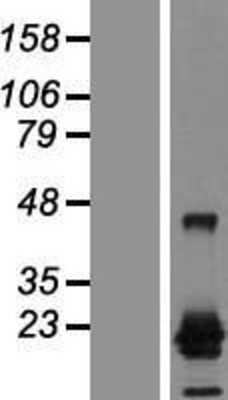 Western Blot: CTAG1A Overexpression Lysate [NBP2-05569]