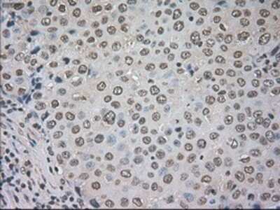 Immunohistochemistry-Paraffin: CTAG1B Antibody (OTI2B6) [NBP1-47714]
