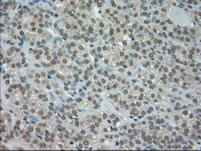 Immunohistochemistry-Paraffin: CTAG1B Antibody (OTI2B6) [NBP1-47714]