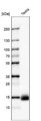 Western Blot: CTAG1B Antibody (CL10130) [NBP2-88943]