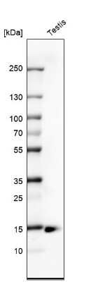 Western Blot: CTAG1B Antibody (CL10165) [NBP2-88944]