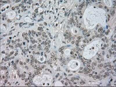 Immunohistochemistry: CTAG1B Antibody (OTI2B6) - Azide and BSA Free [NBP2-70485]