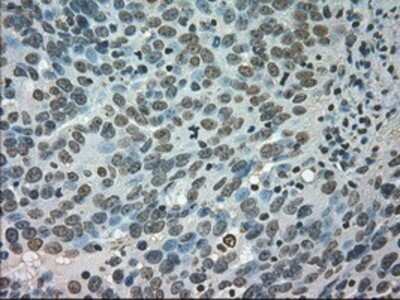 Immunohistochemistry: CTAG1B Antibody (OTI2B6) - Azide and BSA Free [NBP2-70485]