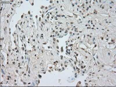 Immunohistochemistry: CTAG1B Antibody (OTI2B6) - Azide and BSA Free [NBP2-70485]