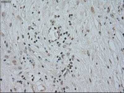 Immunohistochemistry: CTAG1B Antibody (OTI2B6) - Azide and BSA Free [NBP2-70485]